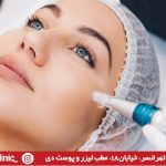 میکرونیدلینگ در تهرانسر | مطب لیزر و پوست دی