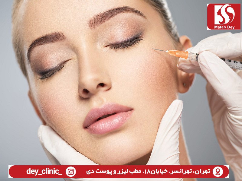بوتاکس | بوتاکس چشم |انجام بوتاکس در تهرانسر