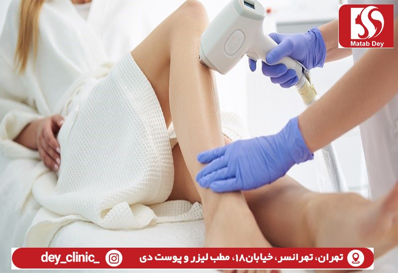 لیزرموهای زائد تهرانسر